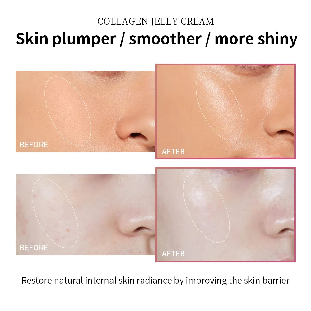 Crema Gelatina Collagene + Niacinamide - Effetto "Glass Skin" Rimpolpante Unisex | Scelta Top