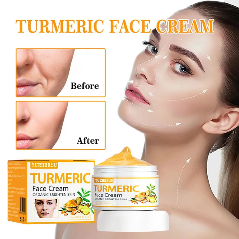 Crema Viso Curcuma Anti-Acne - Trattamento Brufoli, Macchie Post-Acne, Pelle Grassa | Scelta Top