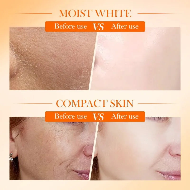Crema SADOER Vitamina C 5x Illuminante Anti-Macchie - Effetto Glow Istantaneo | Scelta Top