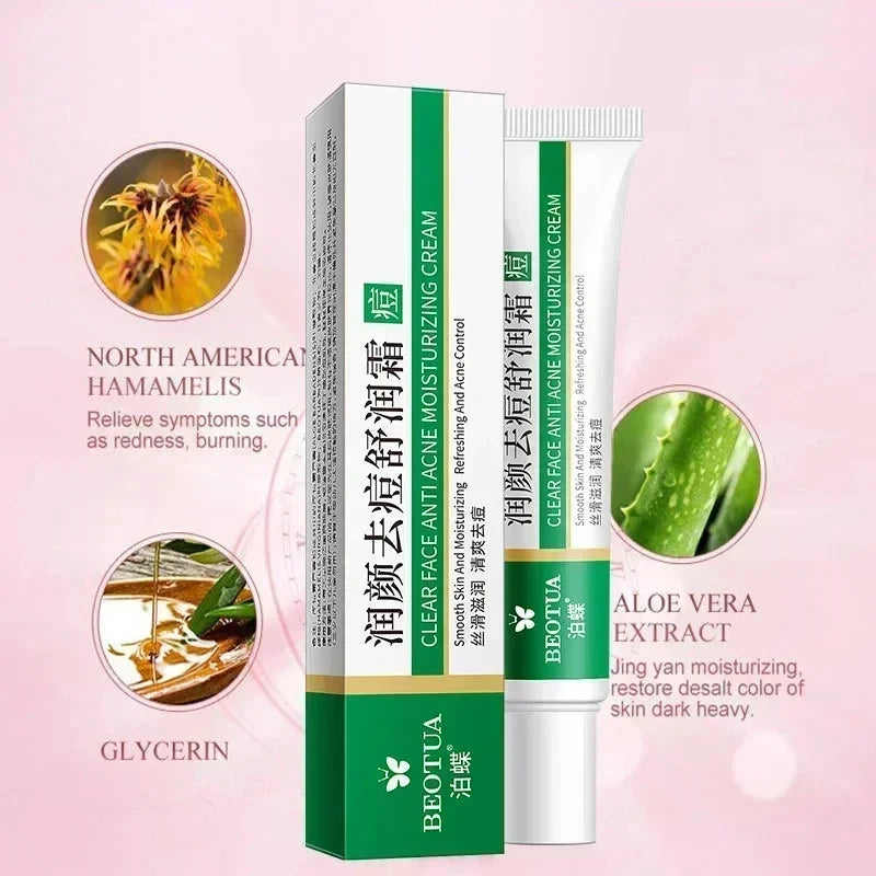 Crema Anti-Acne Riparatrice 3 in 1 - Brufoli, Cicatrici, Punti Neri | Scelta Top