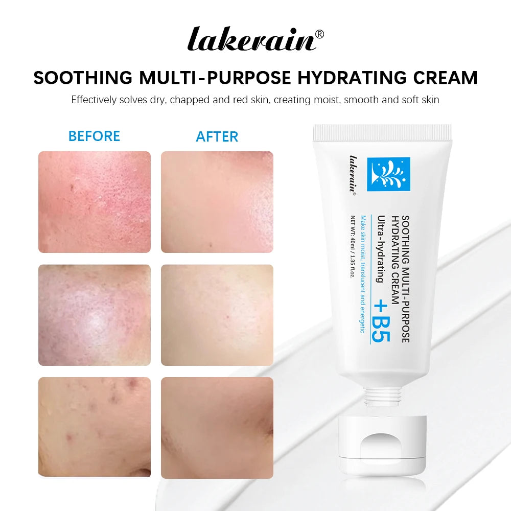 Crema B5 Riparatrice SOS - Pantenolo per Pelle Secca, Rossori, Irritazioni | Scelta Top