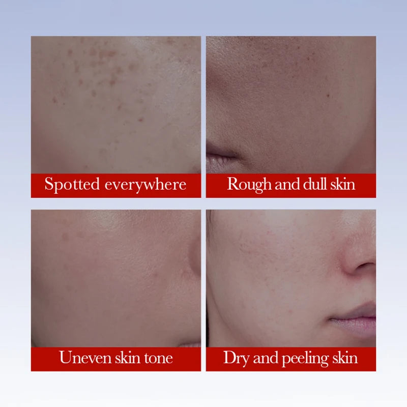Crema Anti-Macchie e Lentiggini SADOER - Schiarente Viso Coreana | Scelta Top