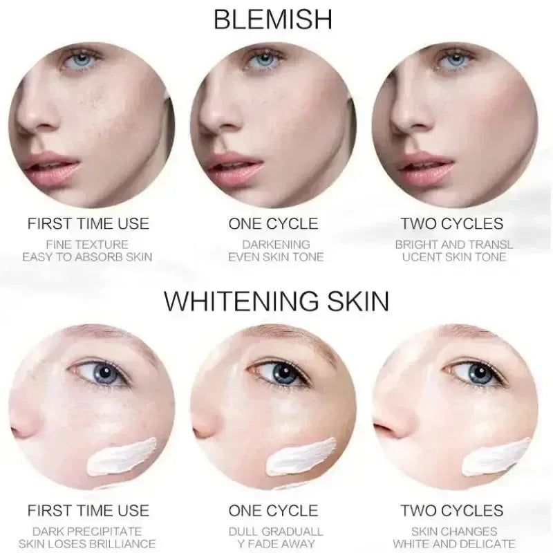 Crema Anti-Macchie Intensiva - Sbiancante Lentiggini, Macchie Solari e Post-Brufolo | Scelta Top